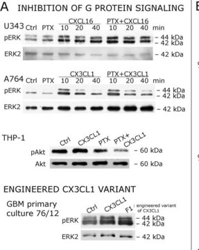 Anti-MAP Kinase 2/Erk2 Antibody, clone 1B3B9 clone 1B3B9, Upstate&#174;, from mouse