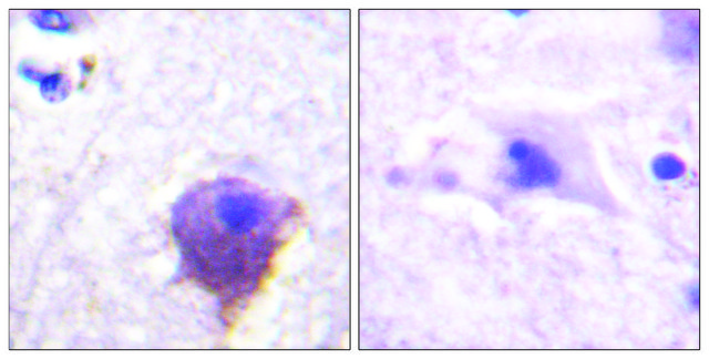 Anti-MAP4 antibody produced in rabbit affinity isolated antibody