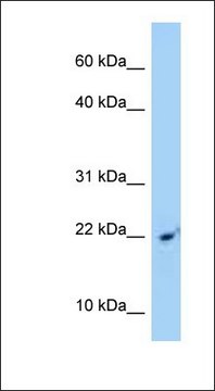 Anti-SRP14 antibody produced in rabbit affinity isolated antibody