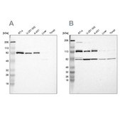 Anti-CARS antibody produced in rabbit Ab1, Prestige Antibodies® Powered by Atlas Antibodies, affinity isolated antibody, buffered aqueous glycerol solution