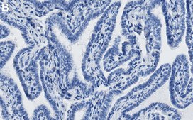 Anti-PCIF1 Antibody, clone 1E21 ZooMAb® Rabbit Monoclonal recombinant, expressed in HEK 293 cells