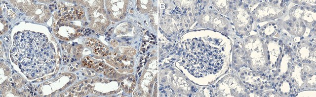 Anti-phospho-MAP Kinase1/2 Antibody clone 12D4, Upstate&#174;, from mouse