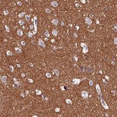 Anti-FAM155A antibody produced in rabbit Prestige Antibodies® Powered by Atlas Antibodies, affinity isolated antibody, buffered aqueous glycerol solution