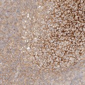 Anti-RABEP1 antibody produced in rabbit Prestige Antibodies® Powered by Atlas Antibodies, affinity isolated antibody, buffered aqueous glycerol solution, Ab3