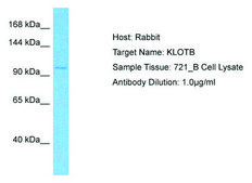 抗-KLB affinity isolated antibody