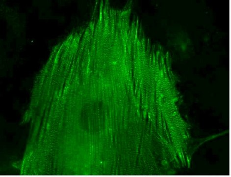 LentiBrite &#945;-actinin-GFP Lentiviral Biosensor