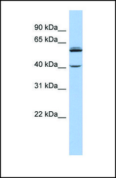 抗-CYP4V2 兔抗 affinity isolated antibody