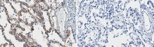 Anti-ITGA3 Antibody, clone 1D6 ZooMAb® Rabbit Monoclonal recombinant, expressed in HEK 293 cells