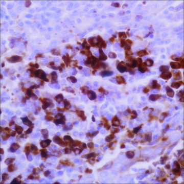 Kappa (EP171) Rabbit Monoclonal Primary Antibody