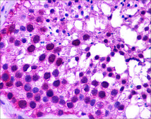 Anti-KLF9 antibody produced in rabbit affinity isolated antibody