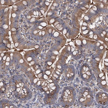 Anti-INPP5B antibody produced in rabbit Prestige Antibodies&#174; Powered by Atlas Antibodies, affinity isolated antibody, buffered aqueous glycerol solution