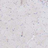 Anti-REC8 antibody produced in rabbit Prestige Antibodies® Powered by Atlas Antibodies, affinity isolated antibody, buffered aqueous glycerol solution