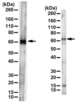 Anti-SLC27A4/FATP4