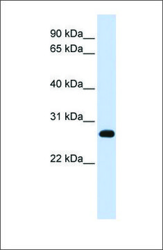 Anti-SNAP23 antibody produced in rabbit affinity isolated antibody