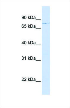 Anti-LCP1 (ab1) antibody produced in rabbit affinity isolated antibody