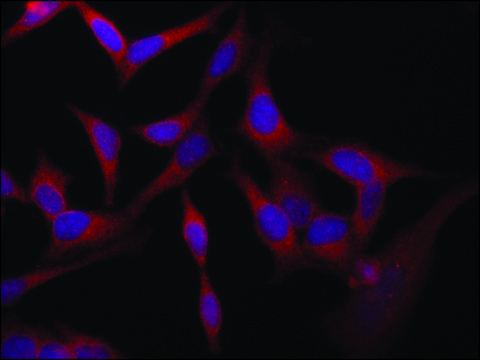 Anti-VAC14 (C-terminal) antibody produced in rabbit ~1.5&#160;mg/mL, affinity isolated antibody, buffered aqueous solution