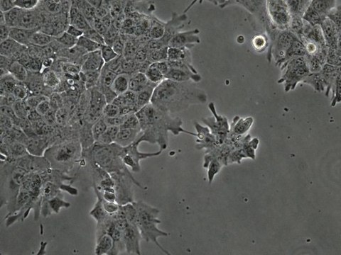 MOC22 Mouse Oral Squamous Cell Carcinoma (OSCC) Cell Line