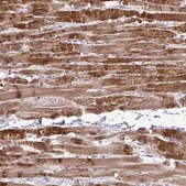 Anti-SYNPO2L antibody produced in rabbit Prestige Antibodies® Powered by Atlas Antibodies, affinity isolated antibody, buffered aqueous glycerol solution