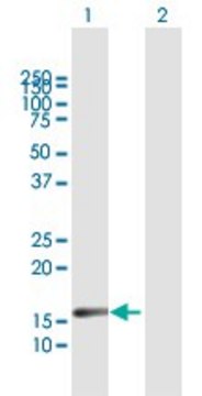 Anti-IL20 antibody produced in mouse purified immunoglobulin, buffered aqueous solution