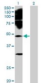 Anti-PAX2 antibody produced in rabbit purified immunoglobulin, buffered aqueous solution