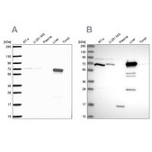 Anti-PCK2 antibody produced in rabbit Prestige Antibodies® Powered by Atlas Antibodies, affinity isolated antibody, buffered aqueous glycerol solution