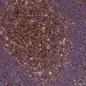 Anti-CSRP2 antibody produced in rabbit Prestige Antibodies® Powered by Atlas Antibodies, affinity isolated antibody, buffered aqueous glycerol solution