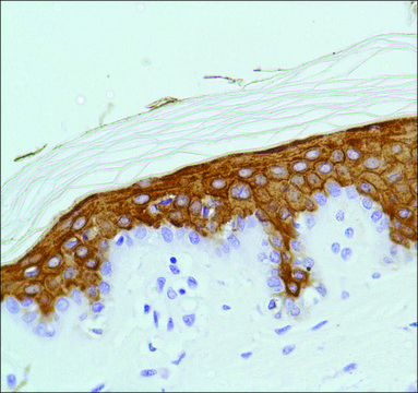 Anti-Keratin 10 antibody, Rabbit monoclonal clone SP99, recombinant, expressed in proprietary host, affinity isolated antibody