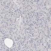 Anti-CD22 antibody produced in rabbit Prestige Antibodies® Powered by Atlas Antibodies, affinity isolated antibody, buffered aqueous glycerol solution