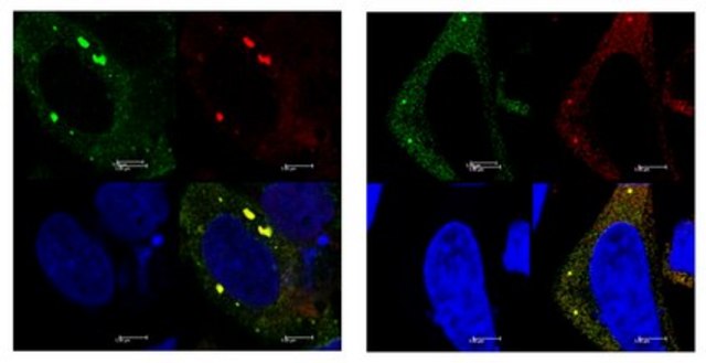 Anti-YTHDF2 Antibody from rabbit, purified by affinity chromatography