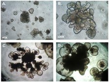 Definitive Endoderm Induction Medium