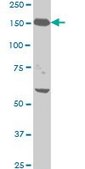 Monoclonal Anti-NEFH antibody produced in mouse clone 2E8, purified immunoglobulin, buffered aqueous solution