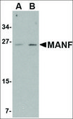 抗 MANF 兔抗 affinity isolated antibody, buffered aqueous solution