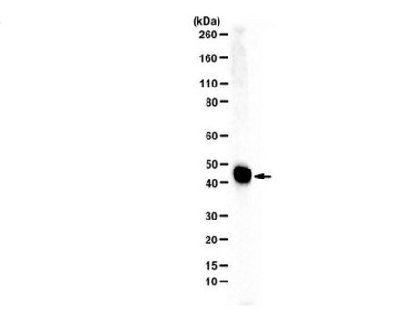 Anti-Ferrochelatase serum, from rabbit