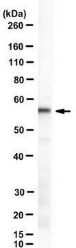 Anti-ZDHHC13 Antibody, clone 26D1 clone 26D1, from mouse