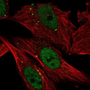 Anti-CTSC antibody produced in rabbit Prestige Antibodies&#174; Powered by Atlas Antibodies, affinity isolated antibody