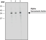 Anti-Actin (α-Sarcomeric) antibody, Mouse monoclonal clone 5C5, hybridoma cell culture supernatant