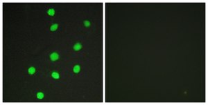 Anti-GLI-3 antibody produced in rabbit affinity isolated antibody