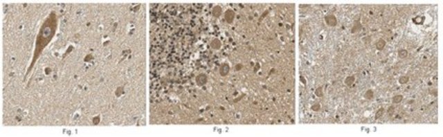 Anti-FGF-20 Antibody from rabbit, purified by affinity chromatography