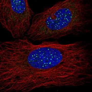 Anti-TINF2 antibody produced in rabbit Prestige Antibodies&#174; Powered by Atlas Antibodies, affinity isolated antibody