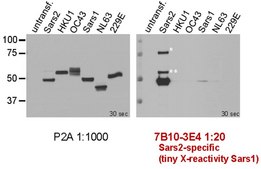 Anti-SARS-CoV-2 nucleocapsid Antibody, clone 7B10-3E4
