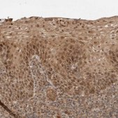 Anti-CAAP1 antibody produced in rabbit Prestige Antibodies® Powered by Atlas Antibodies, affinity isolated antibody, buffered aqueous glycerol solution, Ab2