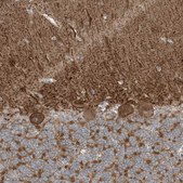 Anti-SLC4A10 antibody produced in rabbit Prestige Antibodies® Powered by Atlas Antibodies, affinity isolated antibody, buffered aqueous glycerol solution