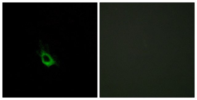 Anti-CARD10 antibody produced in rabbit affinity isolated antibody