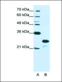 Anti-ANP32A (AB2) antibody produced in rabbit IgG fraction of antiserum