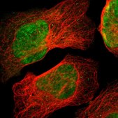Anti-ZSCAN30 antibody produced in rabbit Prestige Antibodies® Powered by Atlas Antibodies, affinity isolated antibody, buffered aqueous glycerol solution