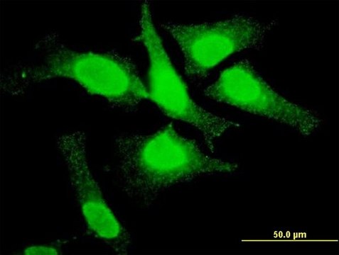 ANTI-TOP3B antibody produced in mouse clone 4H7, purified immunoglobulin, buffered aqueous solution