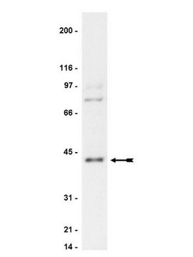 Anti-PKA Antibody, NT Upstate&#174;, from rabbit