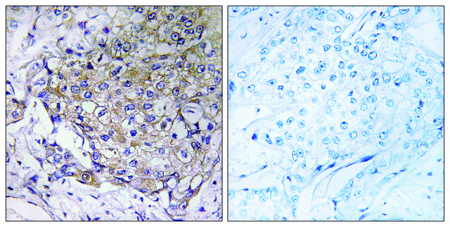 Anti-WASF3 antibody produced in rabbit affinity isolated antibody