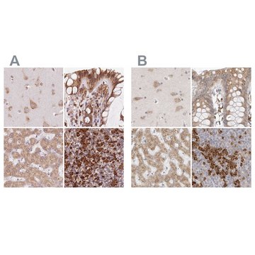 Anti-RPN1 antibody produced in rabbit Prestige Antibodies&#174; Powered by Atlas Antibodies, affinity isolated antibody