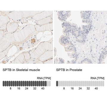 Anti-SPTB antibody produced in rabbit Ab1, Prestige Antibodies&#174; Powered by Atlas Antibodies, affinity isolated antibody, buffered aqueous glycerol solution